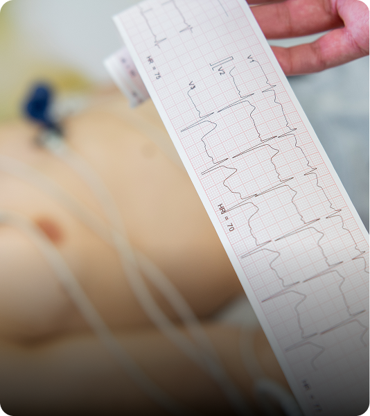 Electrocardiograma - ACTIVE