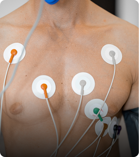 HOLTER DE 24 HORAS - ACTIVE